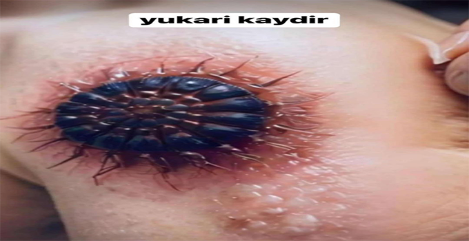 Kızcağızın yüzünde belirdi